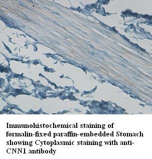 CNN1 antibody (pAb)