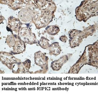 RIPK2 antibody (pAb) RIPK2 antibody (pAb)