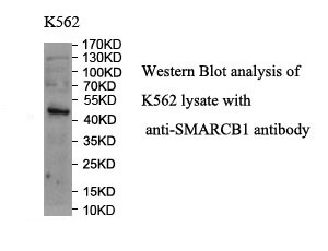 SMARCB1 antibody (pAb) SMARCB1 antibody (pAb)