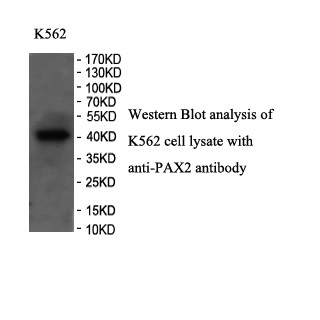 PAX2 antibody (pAb) PAX2 antibody (pAb)