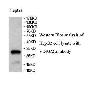 VDAC2 antibody (pAb) VDAC2 antibody (pAb)