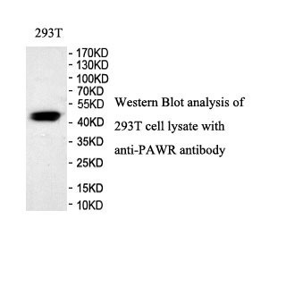 PAWR antibody (pAb) PAWR antibody (pAb)