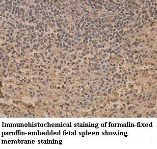 TNFRSF10B antibody (pAb) TNFRSF10B antibody (pAb)