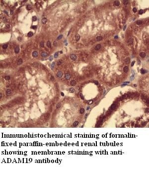 ADAM19 antibody (pAb)
