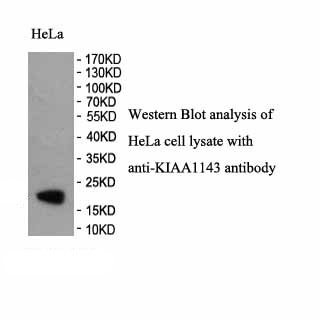 KIAA1143 antibody (pAb) KIAA1143 antibody (pAb)