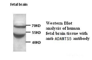 ADAMTS5 antibody (pAb) ADAMTS5 antibody (pAb)