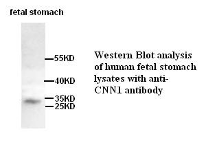 CNN1 antibody (pAb)
