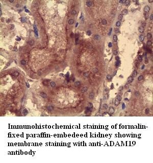 ADAM19 antibody (pAb)
