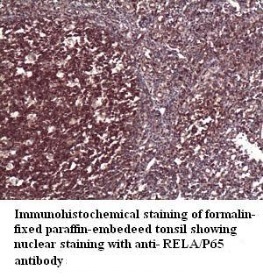 RELA antibody (pAb) RELA antibody (pAb)