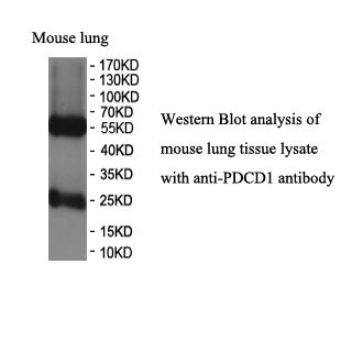 PD1 antibody (mAb) PD1 antibody (mAb)