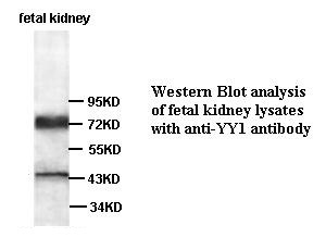 YY1 antibody (pAb) YY1 antibody (pAb)