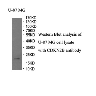 CDKN2B antibody (pAb) CDKN2B antibody (pAb)