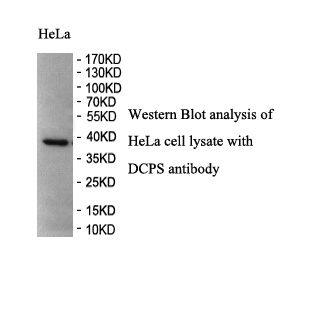 DCPS antibody (pAb) DCPS antibody (pAb)