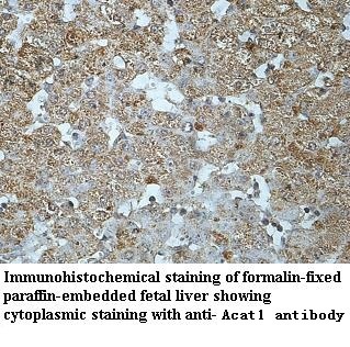 SOAT1 antibody (pAb)