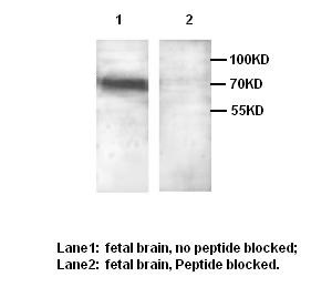 NOTCH2 antibody (pAb)