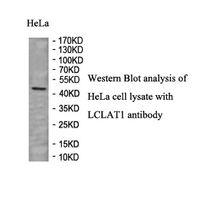 LCLAT1 antibody (pAb) LCLAT1 antibody (pAb)