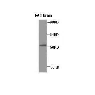 SEPTIN4 antibody (pAb) SEPTIN4 antibody (pAb)