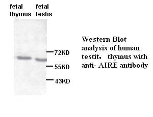 AIRE antibody (pAb)