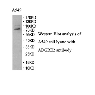 ADGRE2 antibody (pAb) ADGRE2 antibody (pAb)