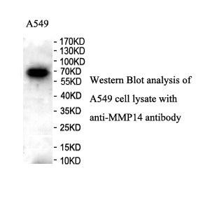 MMP14 antibody (pAb) MMP14 antibody (pAb)