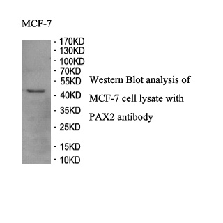 PAX2 antibody (pAb) PAX2 antibody (pAb)