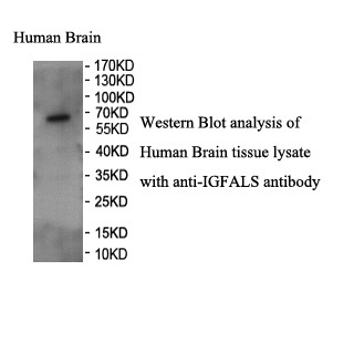 IGFALS antibody (pAb) IGFALS antibody (pAb)