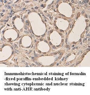 AHR antibody (pAb)