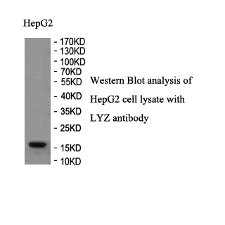 LYZ antibody (pAb) LYZ antibody (pAb)