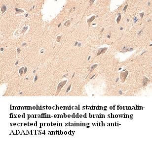 ADAMTS4 antibody (pAb) ADAMTS4 antibody (pAb)