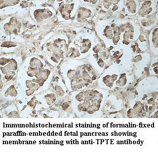TPTE antibody (pAb) TPTE antibody (pAb)