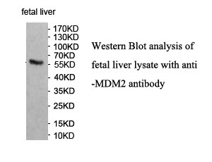 MDM2 antibody (pAb) MDM2 antibody (pAb)