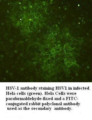 HSV-1 GP (glycoprotein, gP-110) antibody(mAb) HSV-1 GP (glycoprotein, gP-110) antibody(mAb)