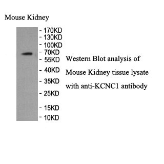 KCNC1 antibody (pAb) KCNC1 antibody (pAb)