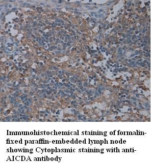 AICDA antibody (pAb)