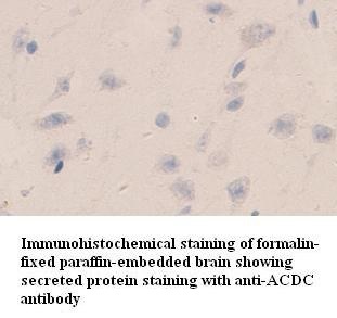 ADIPOQ antibody (pAb) ADIPOQ antibody (pAb)