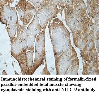 NUDT9 antibody (pAb) NUDT9 antibody (pAb)