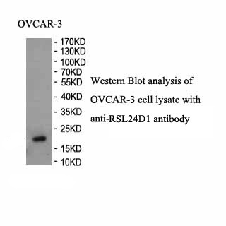RSL24D1 antibody (pAb) RSL24D1 antibody (pAb)