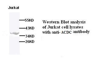 ADIPOQ antibody (pAb) ADIPOQ antibody (pAb)