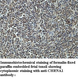 CHRNA1 antibody (pAb) CHRNA1 antibody (pAb)