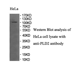 PLD2 antibody (pAb) PLD2 antibody (pAb)