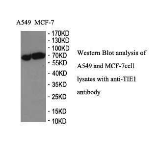 TIE1 antibody (mAb) TIE1 antibody (mAb)