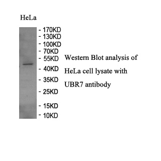 UBR7 antibody (pAb) UBR7 antibody (pAb)