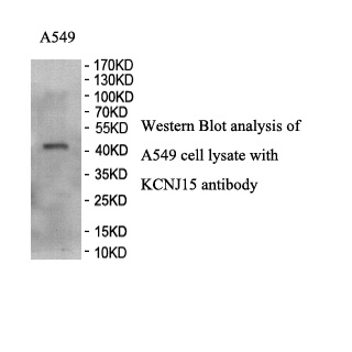 KCNJ15 antibody (pAb) KCNJ15 antibody (pAb)