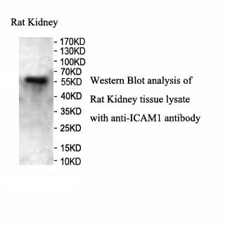 ICAM1 antibody (pAb) ICAM1 antibody (pAb)
