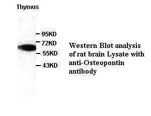 SPP1 antibody (pAb) SPP1 antibody (pAb)