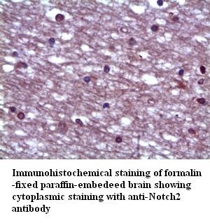 NOTCH2 antibody (pAb)