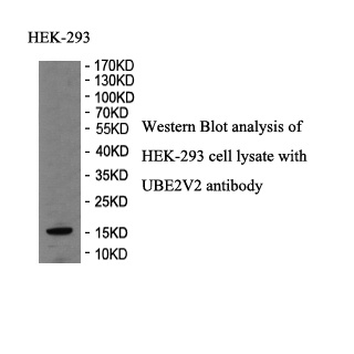 UBE2V2 antibody (pAb) UBE2V2 antibody (pAb)