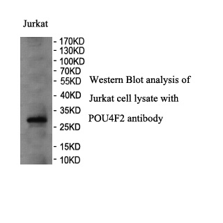 POU4F2 antibody (pAb) POU4F2 antibody (pAb)