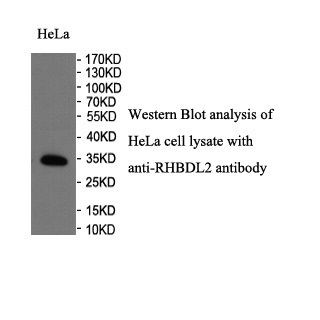 RHBDL2 antibody (pAb) RHBDL2 antibody (pAb)