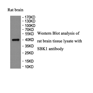 SBK1 antibody (pAb) SBK1 antibody (pAb)